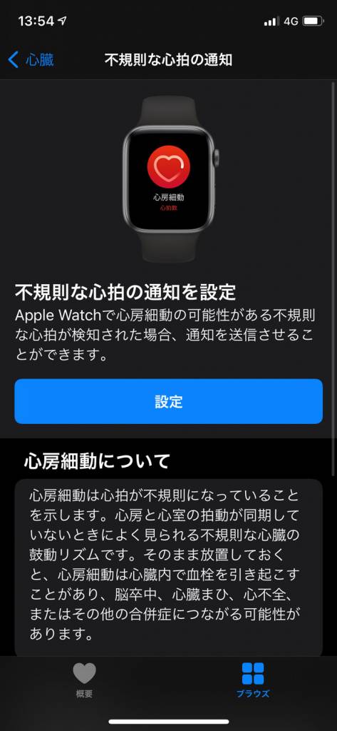 Apple Watch心電図機能アプリの使い方と設定方法